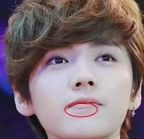 明星脸上的疤是怎么来的?胡歌车祸,千玺打架,最服鹿晗!