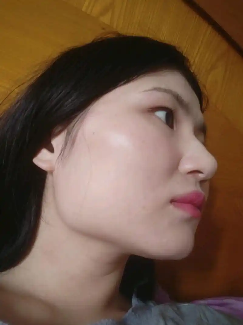 下颌角突出如我,也没几个