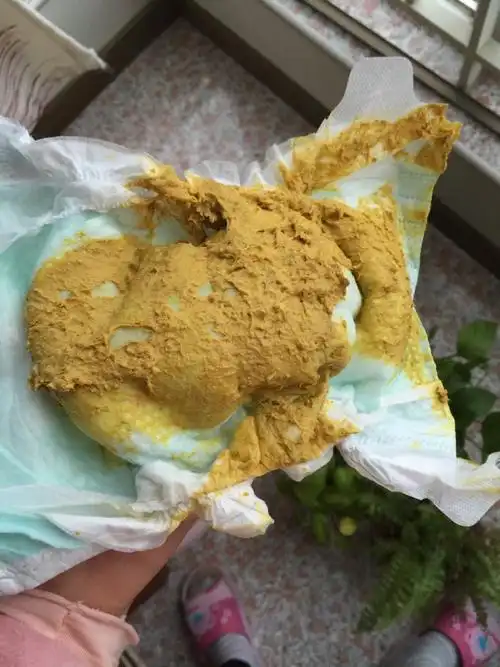 有图慎入. 儿子吃奶粉,每天一次大便