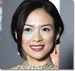 章子怡眼睛是斜视吗