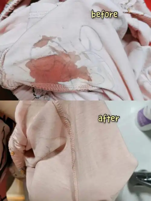 血迹没啦内裤不再扔75真香