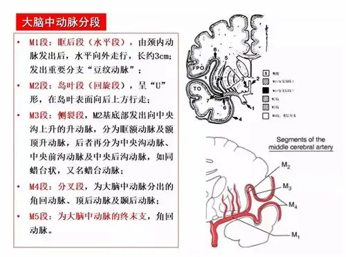 影像必备!脑动脉分段清晰图谱