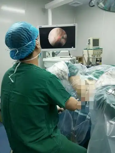 其它 经尿道前列腺钬激光剜除术(holep) 写美篇手术视频 该手术在我院