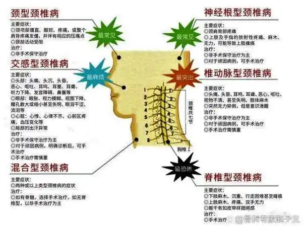 颈椎病的常见类型有哪些?都有什么症状表现?