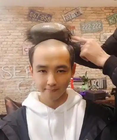 脱发男士如何拥有理想发型