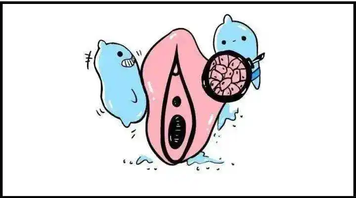 外阴溃疡是众多女性患者"难以启齿的痛",轻者3-7天可以自愈,重者可