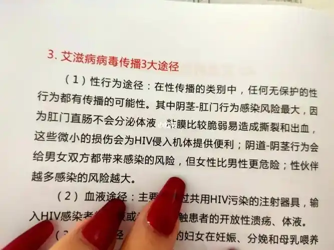 虽然一直知道同性恋  doi比异性恋doi更容易得艾滋病,但是这是第一次