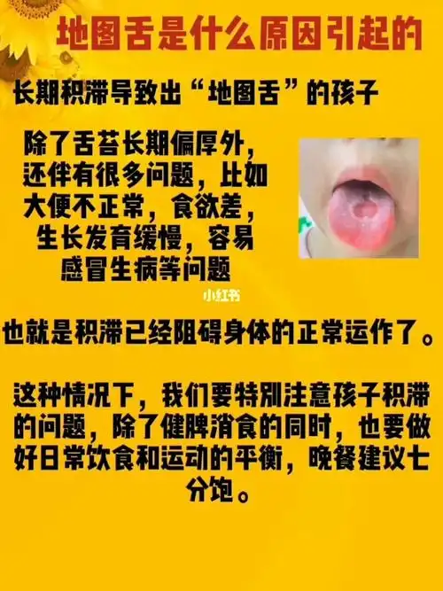 孩子为什么会出现地图舌