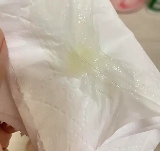 大家帮我看看排卵期这样的白带正常吗内附照片慎点