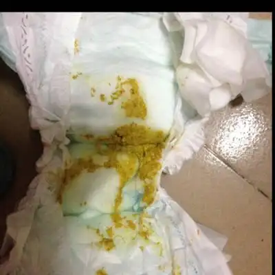 今天拉了三次了