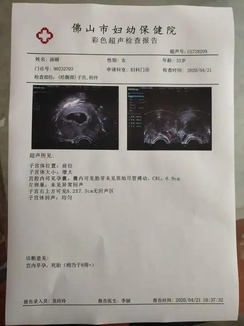 准妈妈怀孕十月需要做多少怀孕b超报告单