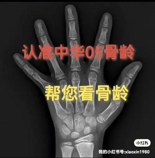可以帮您看看中华05骨龄74又困惑的家长来吧