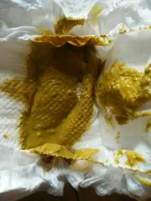 正在使用 残忍拒绝 推荐回答              你家宝宝是不是吃母乳呢