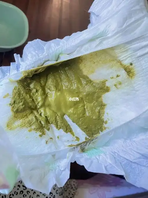 宝宝37天吃蔼儿舒20多天的大便