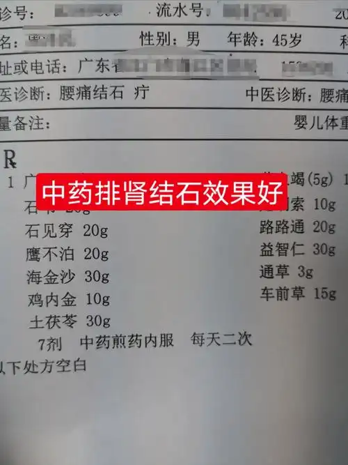 金钱草能治的功效与作用金钱草能排出肾结石吗