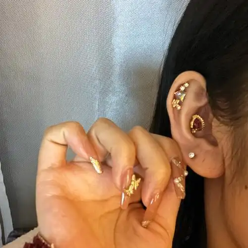 庆祝耳蜗钉耳骨钉都一年了