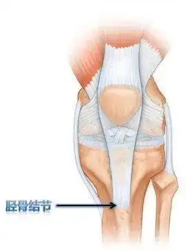 胫骨结节骨软骨炎又称为胫骨结节骨骺炎,osgood-schlatter病,一般发生