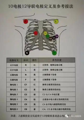 动态心电图佩戴示意图_手机搜狐网