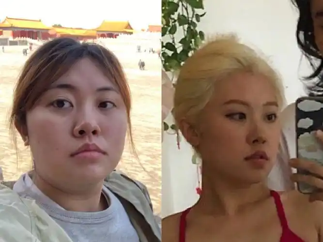 瘦了35斤鼻子的变化