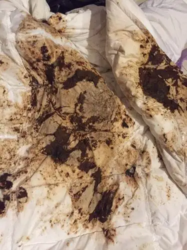 和同学打着玩,我不小心把她推倒了,她倒在了一坨