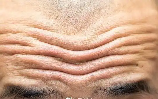 影响呢_面相5,男人天庭二条横纹命运面相风水抬头纹(抬头纹面相图解)