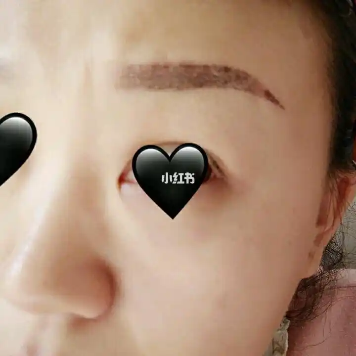 图二是纹眉后第三天,结痂了,刚开始颜色还是挺深的,图一是最后成型的
