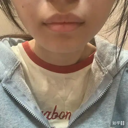 嘴唇厚而且外翻真的超级丑? - 知乎