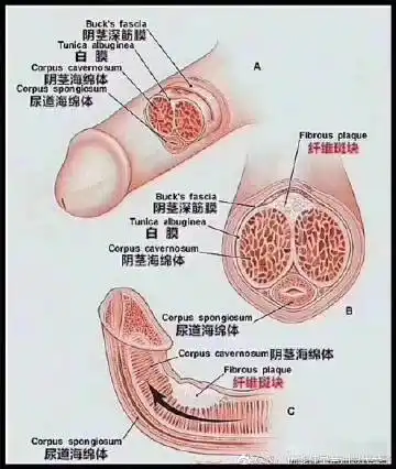 3.包皮长,频繁手淫必然龟头敏感度高,    全文