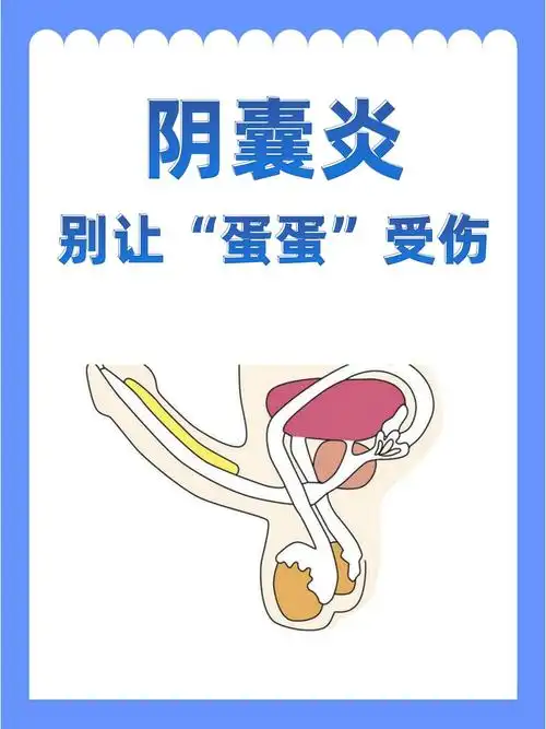 阴囊炎,别让"蛋蛋"受伤