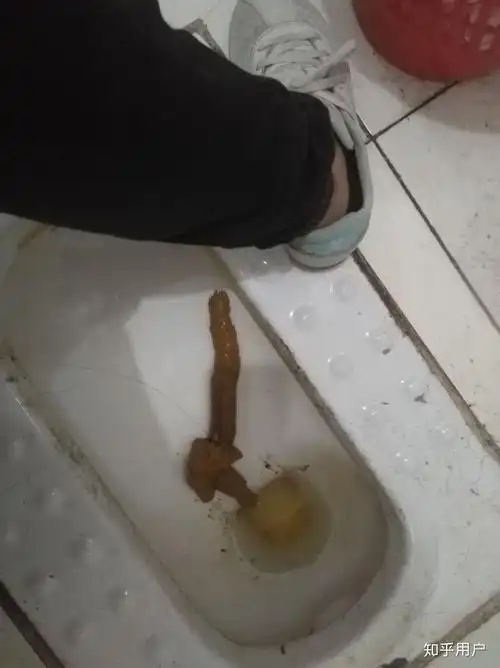 如何拉出一根50cm长的屎?