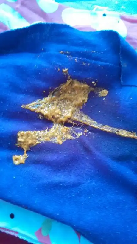 宝宝刚四十天,今天上午不知道怎么回事拉了七八次,便便这样正常吗?