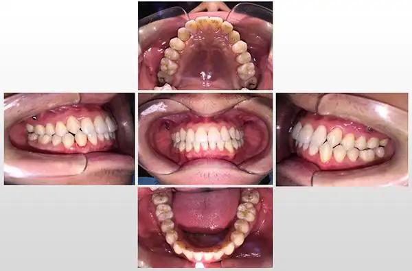 紧密协作高度融合柳人医口腔科门诊三个团队携手为患者解忧