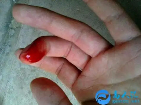 梦见手流血是什么意思有什么预兆