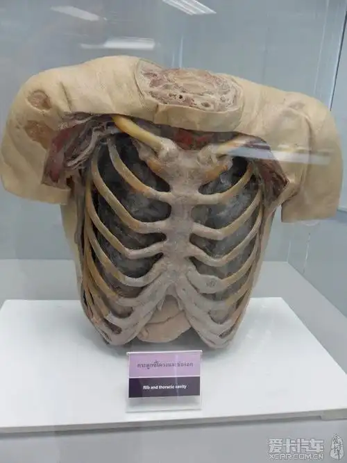 泰国曼谷真人解剖展览胆小勿入
