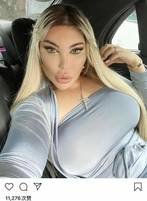 原创巴西男花百万全身整容从腹肌到牙齿全是假体脸丑却靠衣品出名