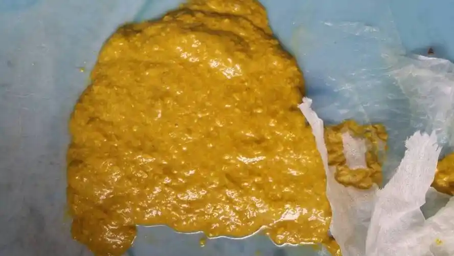 2014-01-06 李其朝 医师 两个月大的婴儿拉屎有泡沫还带酸臭味吃奶