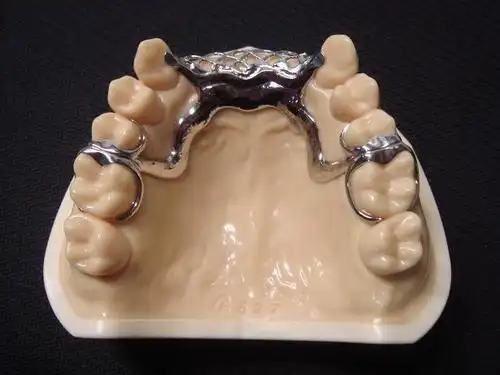 几例vitallium钢托的设计