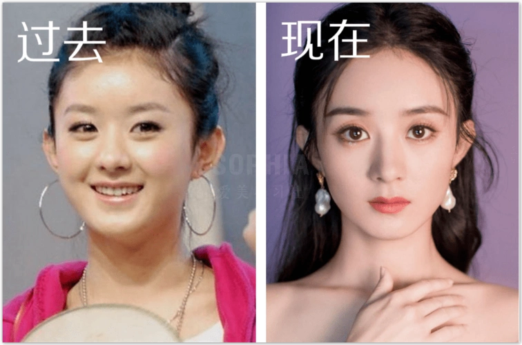 女明星出道前后变化大?
