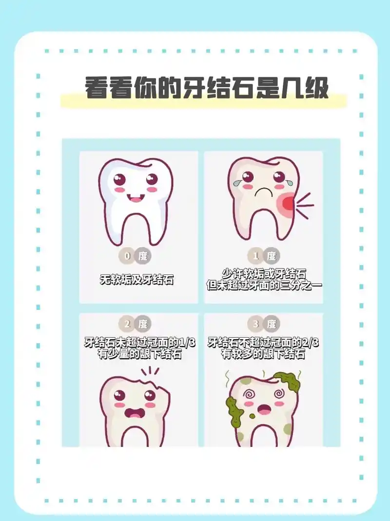 你真的知道你的牙结石是怎么形成的吗?有没有想过 - 抖音