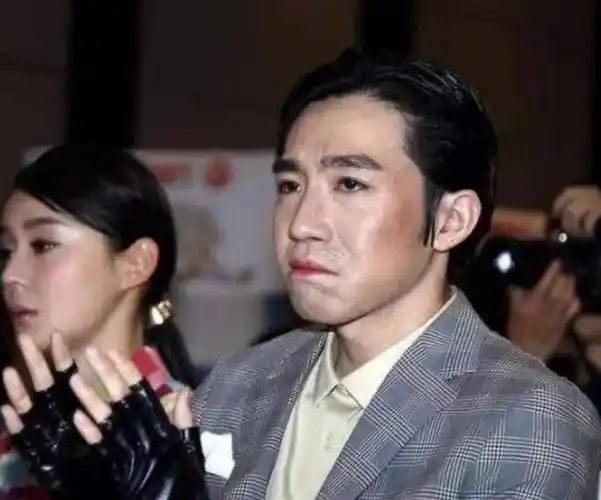 当年烧伤毁容,任家萱为什么没有感谢救她的俞灏明?