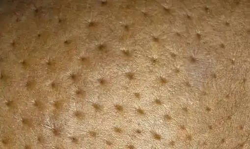 您想知道的乳腺癌科普~_乳腺癌_症状表现_检查_治疗方式 - 好大夫在线