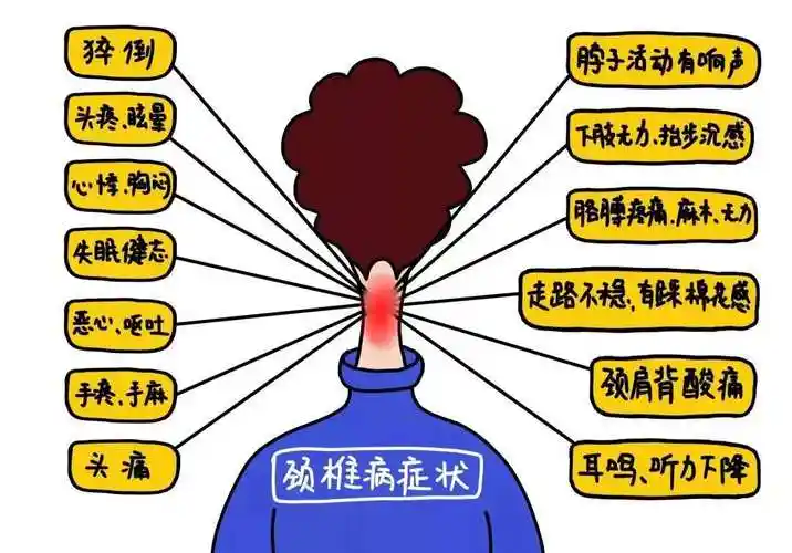 动静医生丨颈椎病只是脖子痛吗你想得太简单了