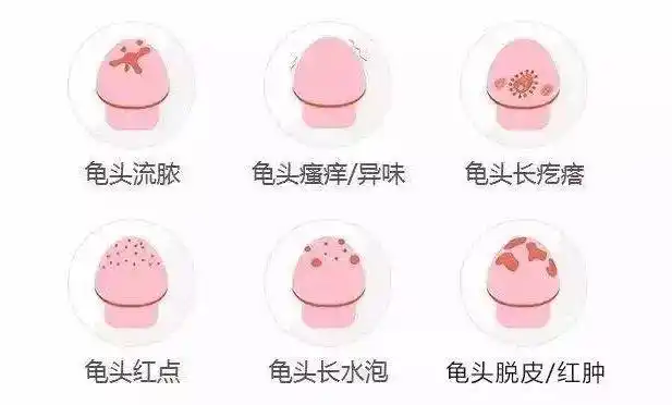 龟头周围长一些小疙瘩是怎么回事?是性病吗?