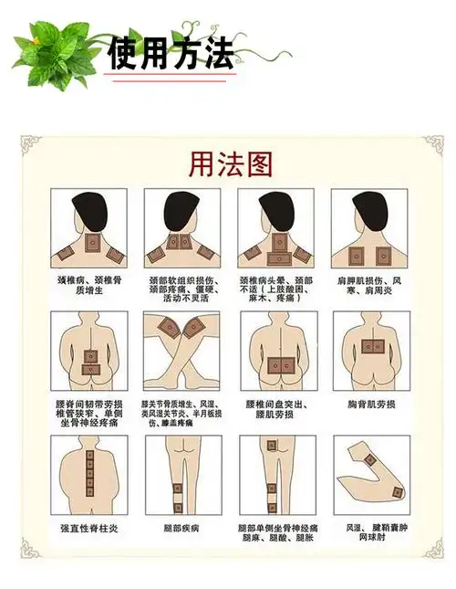 石膏突出的脖子腰椎类风湿性关节炎