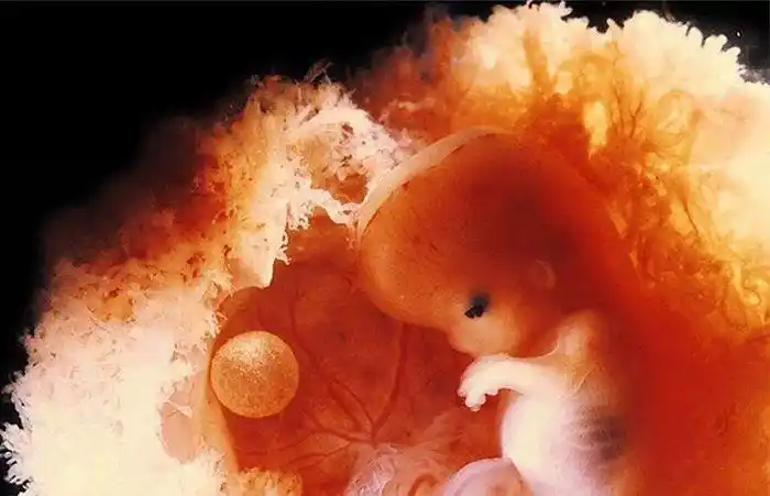 刚怀孕的女性,这两件事情如果不避开,会对胎囊发育造成影响