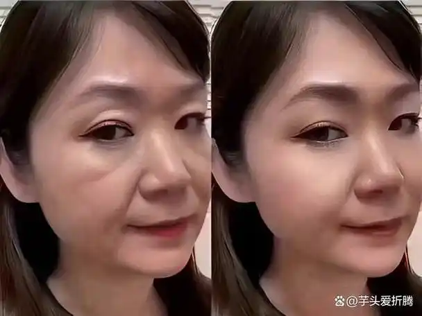 印第安纹是哪个部位?