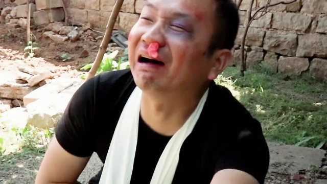 两口子打架小伙被打的鼻青脸肿找表哥评理才知媳妇是拳击冠军