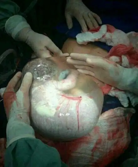 产房实拍9斤男宝出生全过程, 见证超震撼的瞬间!