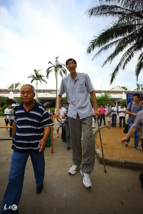中国第一巨人赵亮,自然生长身高达到2.46米