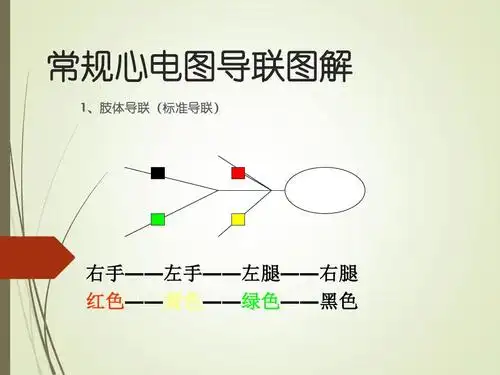 常规心电图图解